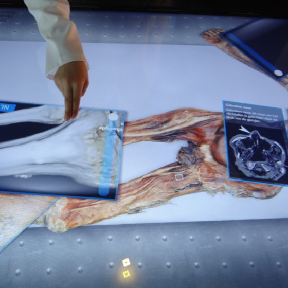 exhibition the iceman crack the cold case hands-on
